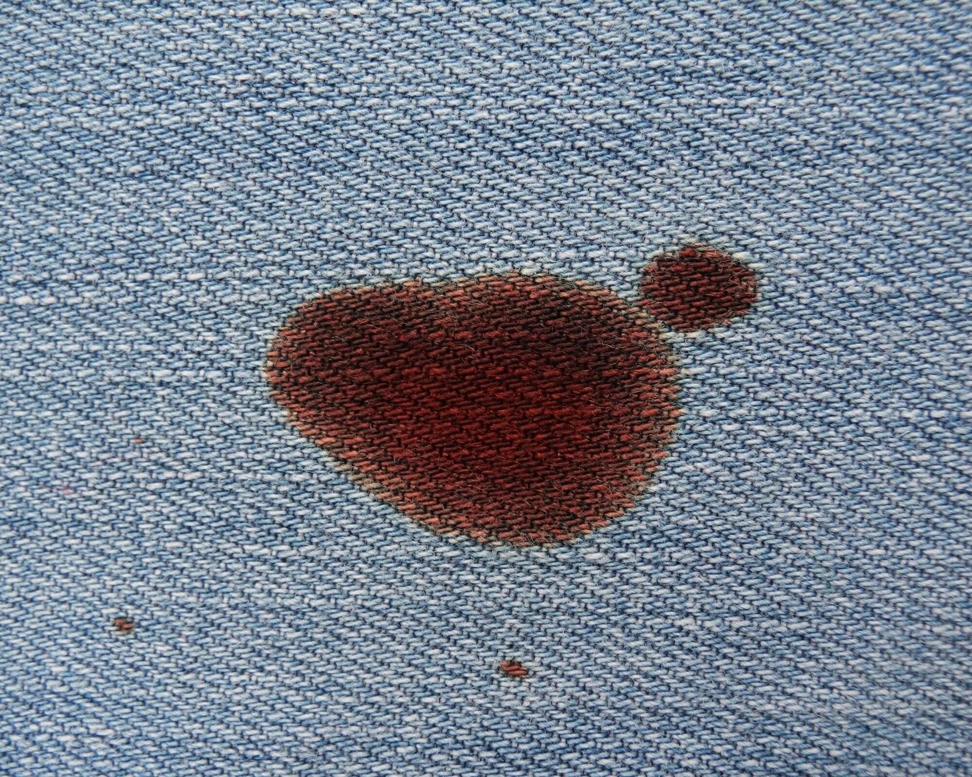 Bloedvlek Verwijderen – Tips van Cinco Cleaning